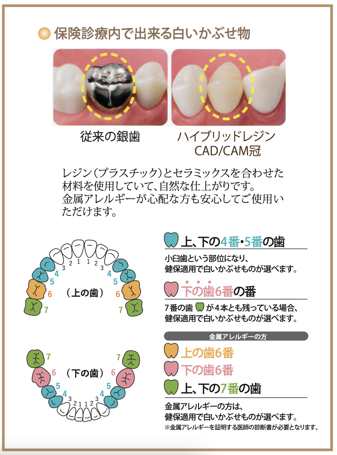 保険でできる白い歯